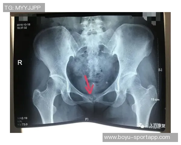 尼科威廉姆斯谈耻骨炎恢复过程并表示需带伤出战的挑战与决心